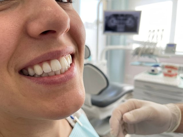 Estética dental en Lalín