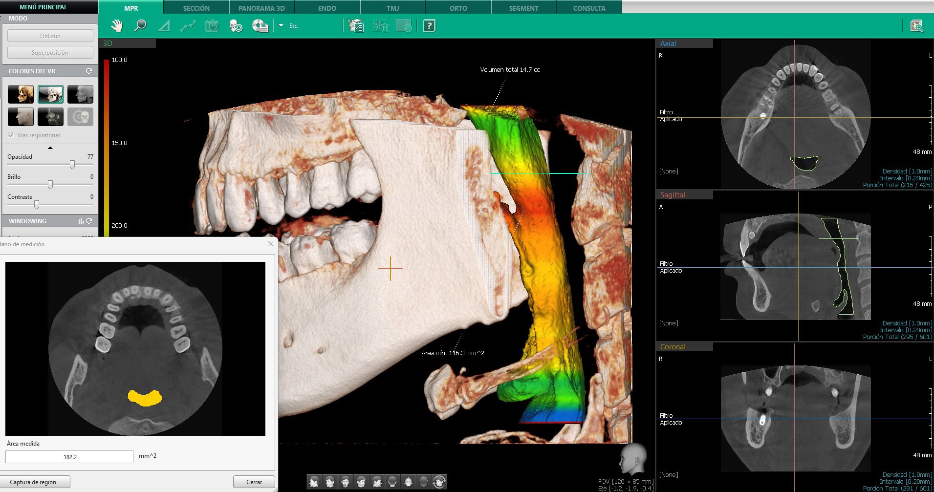 CBCT Green X