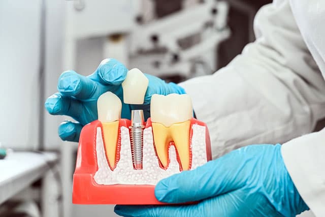 Tratamientos de implantología dental en Lalín