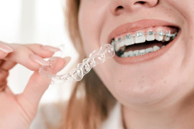 Especialistas en tratamientos de ortodoncia en Lalín