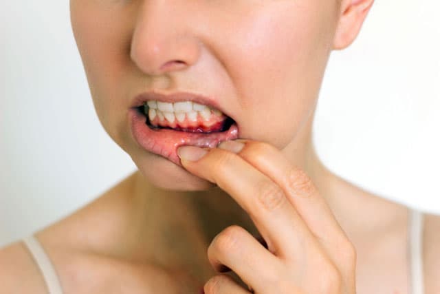Expertos en periodoncia en Lalín