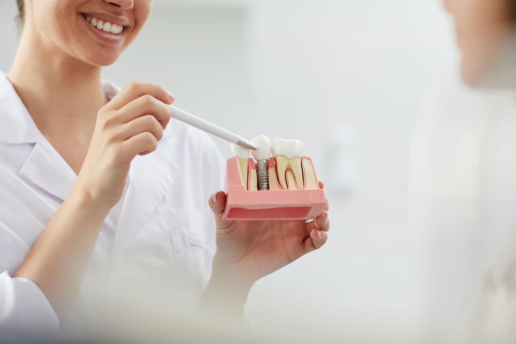 Damos respuesta a tus dudas sobre implantes