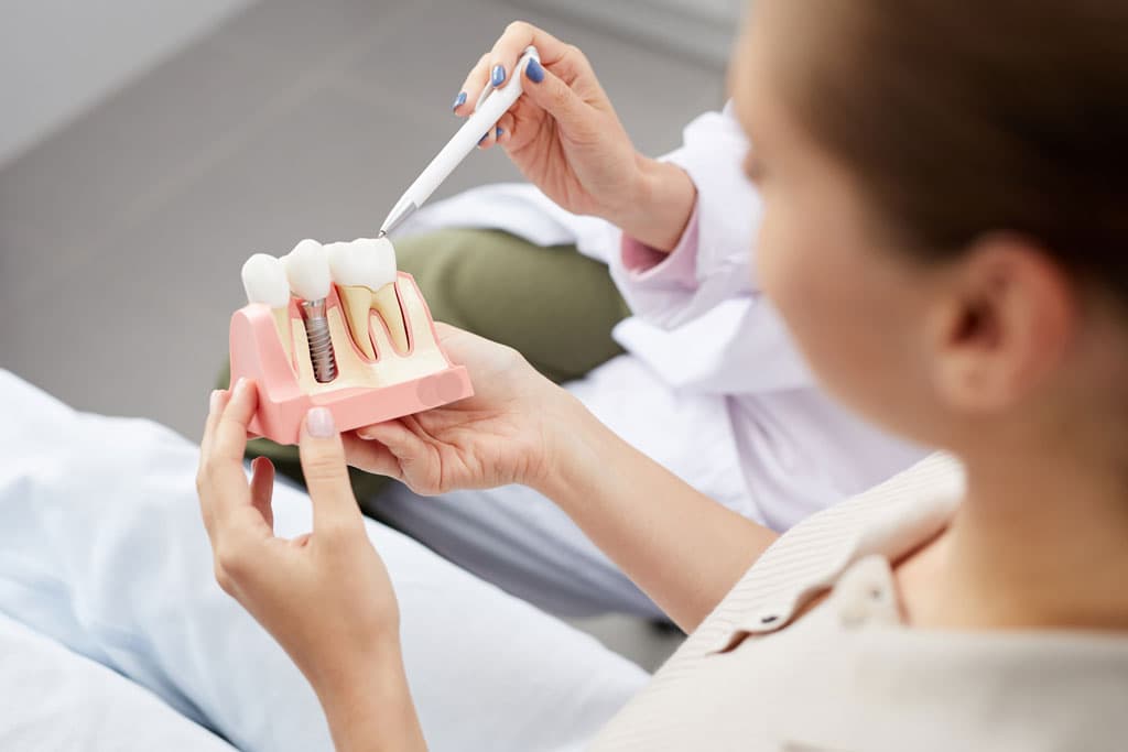 ¿Qué son los implantes dentales?